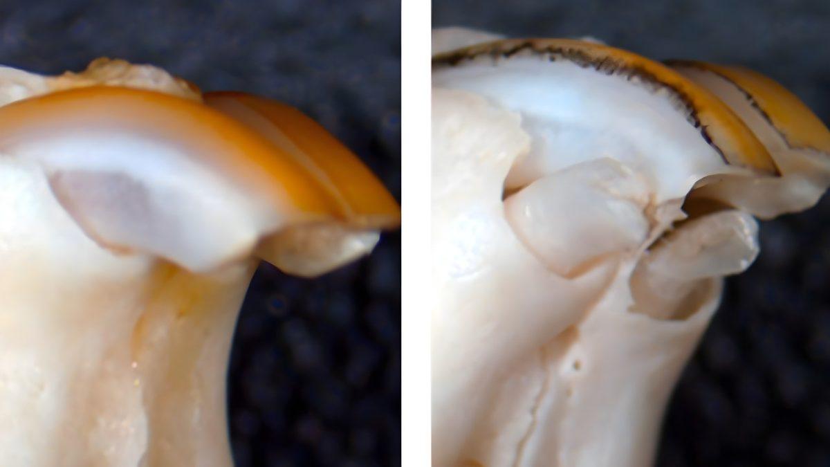 Müjdemizi İsteriz: Kaybettiğiniz Dişlerin Yenisinin Çıkması 