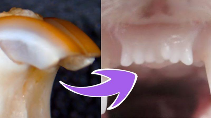 Müjdemizi İsteriz: Kaybettiğiniz Dişlerin Yenisinin Çıkması "Bir İlaç Sayesinde" Mümkün Olabilir! Peki Ama Nasıl?