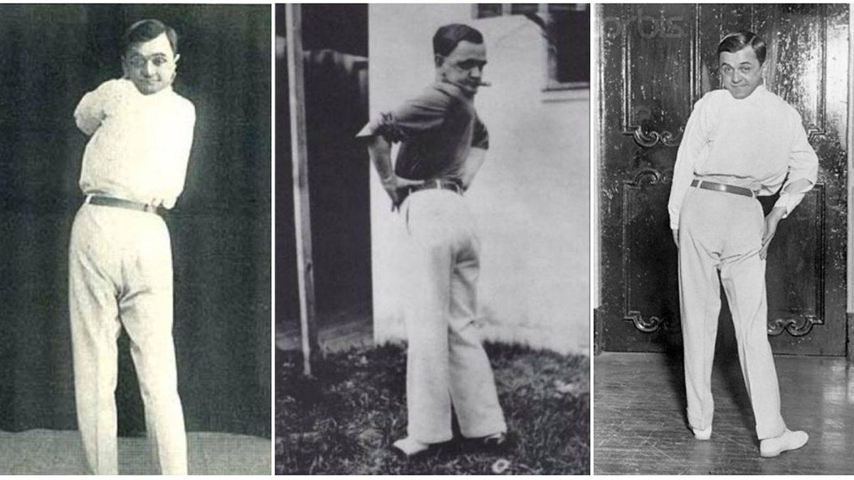 Kafasını 120 Derece Döndürebildiği İçin 