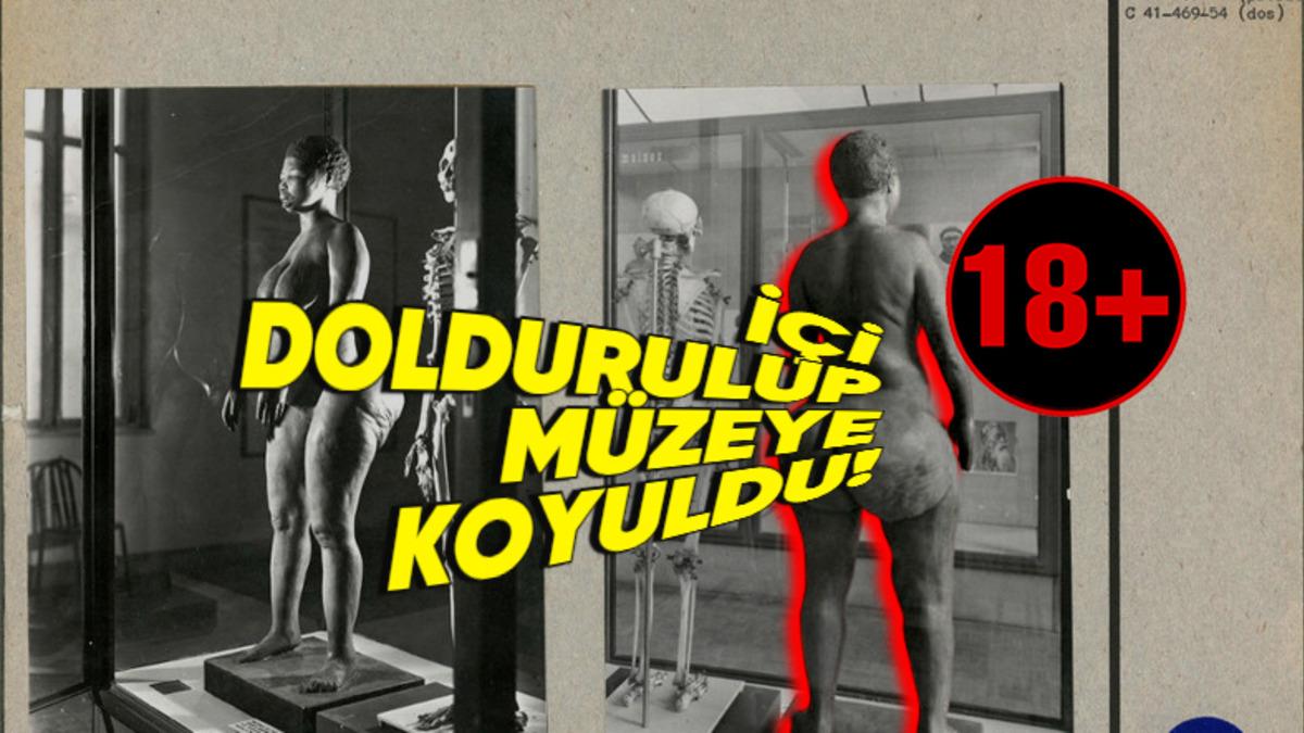 Büyük Bir Kalçası Olduğu İçin Hayatı Boyunca İstismar Edilen Sarah Baartman’ın Sizi İnsanlıktan Soğutacak Öyküsü