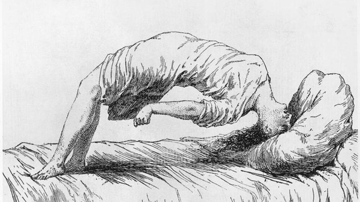 Antik Dönemde Kadınların Rahim Hareketleri Nedeniyle Yaşadığı Düşünülen Fakat Gerçeği Bambaşka Olan Psikolojik Rahatsızlık: Histeri