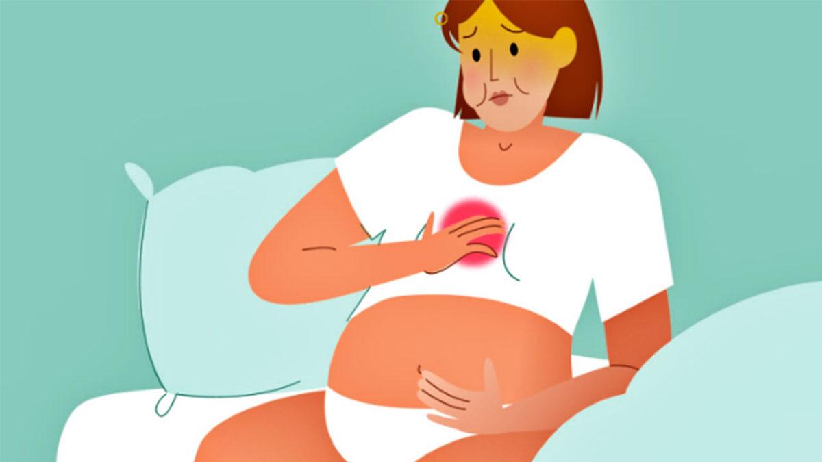 Hamilelikte Mide Yanması Neden Olur, Ne İyi Gelir?