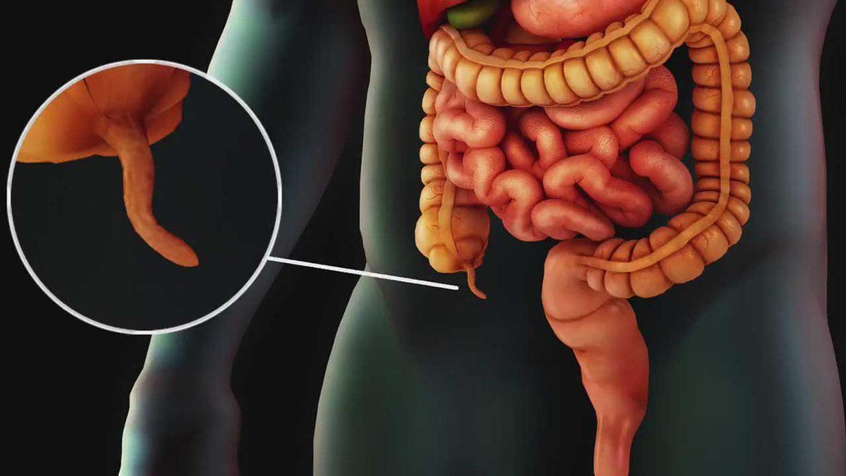 Birbirine Karıştırılan Bu Tıbbi Terimlerin Doğrusunu Öğrenince “Nasıl da Yanlış Kullanıyormuşum!” Diyeceksiniz