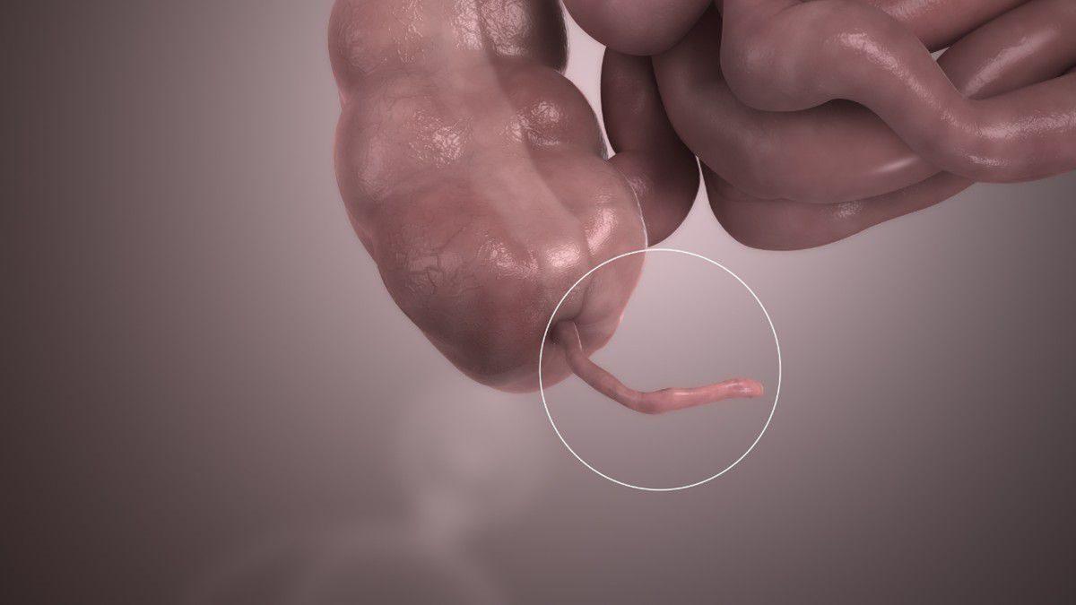 Birbirine Karıştırılan Bu Tıbbi Terimlerin Doğrusunu Öğrenince “Nasıl da Yanlış Kullanıyormuşum!” Diyeceksiniz