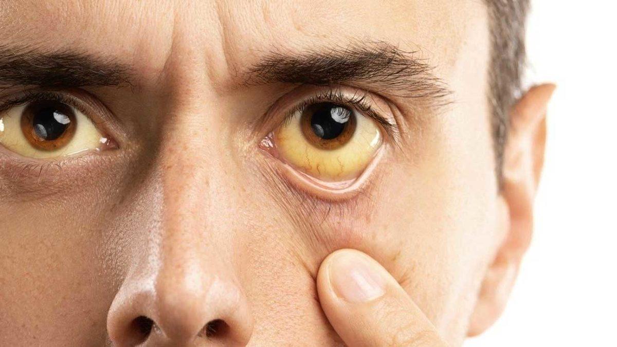 Birbirine Karıştırılan Bu Tıbbi Terimlerin Doğrusunu Öğrenince “Nasıl da Yanlış Kullanıyormuşum!” Diyeceksiniz