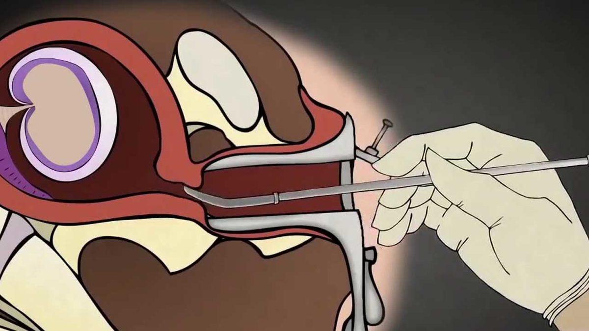 Birbirine Karıştırılan Bu Tıbbi Terimlerin Doğrusunu Öğrenince “Nasıl da Yanlış Kullanıyormuşum!” Diyeceksiniz