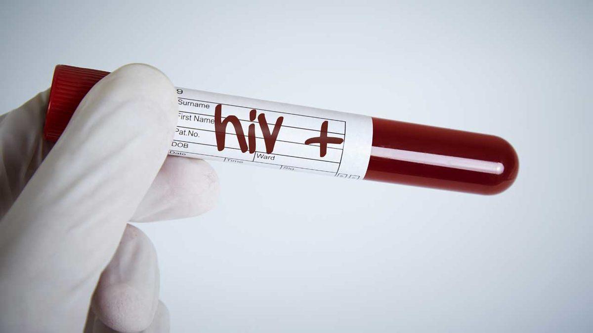 Birbirine Karıştırılan Bu Tıbbi Terimlerin Doğrusunu Öğrenince “Nasıl da Yanlış Kullanıyormuşum!” Diyeceksiniz