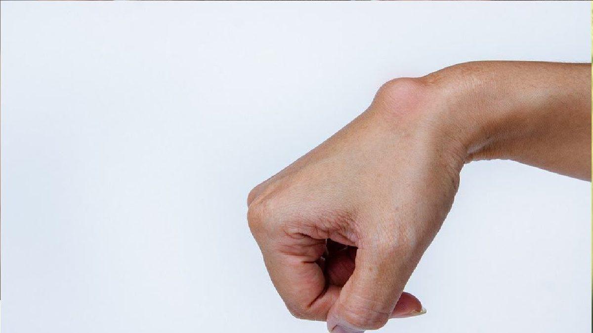 Ciddi Rahatsızlıkların Habercisi Olabildiği İçin Dikkat Etmemiz Gereken ’Kist’ Tam Olarak Nedir, Neden Olur?