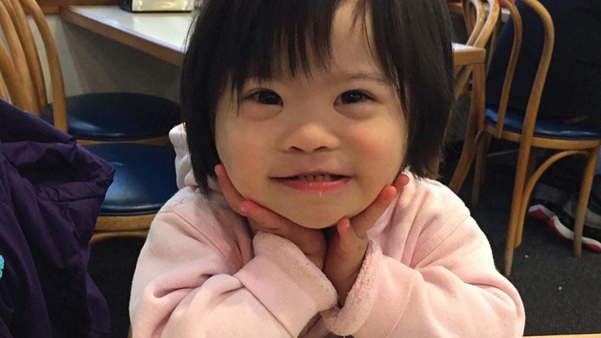 Neden Hiç Siyahi Bir Down Sendromlu Birey Görmüyoruz? Sebebi Genetik Değil!