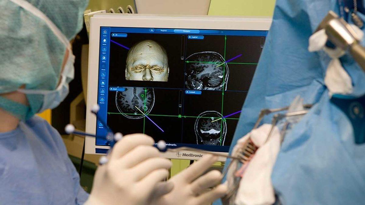 Nasıl Oluyor da Hastalar Uyanık Hâldeyken Bile Beyin Ameliyatı Yapılabiliyor? Dolma Dolduran Bile Var!