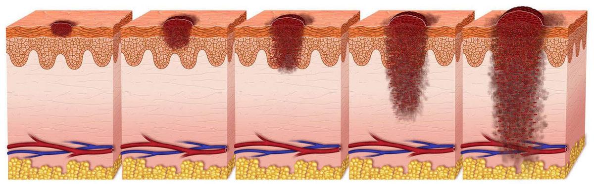 İnsanın İçine Kurt Düşüren Bilimsel Tartışma: Güneş Gözlüğü Takmak Yararlı mı, Zararlı mı?