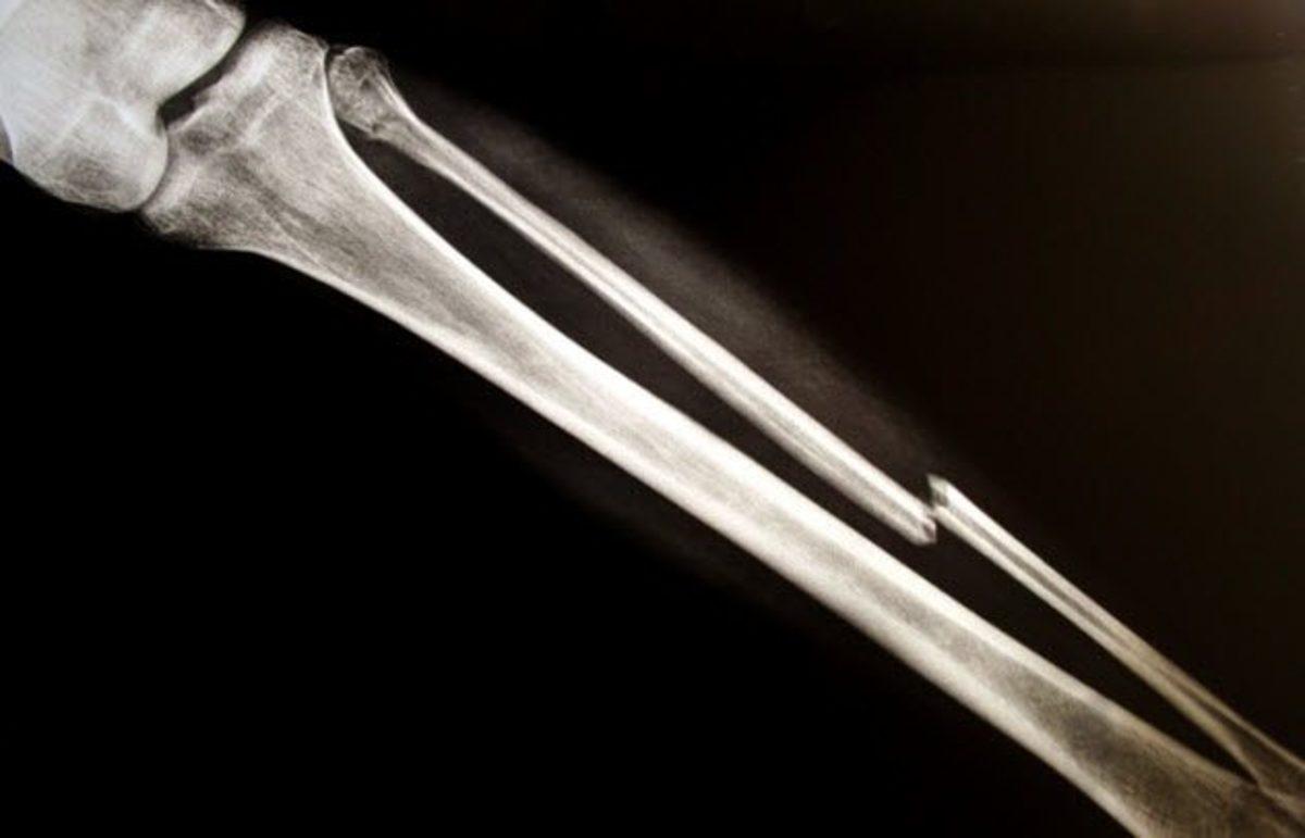 Nazilerin İnsanlar Üzerinde Gerçekleştirdiği Birbirinden Korkunç 12 Deney! (+18)