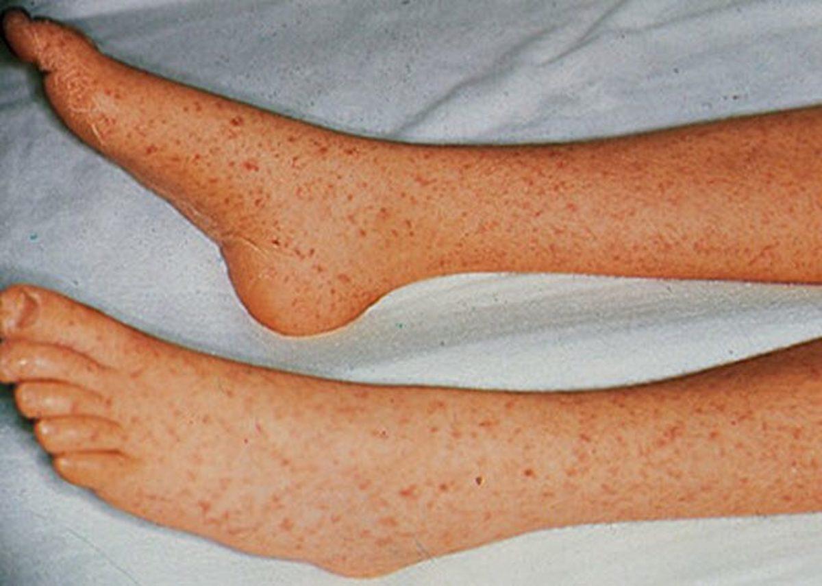 Nazilerin İnsanlar Üzerinde Gerçekleştirdiği Birbirinden Korkunç 12 Deney! (+18)