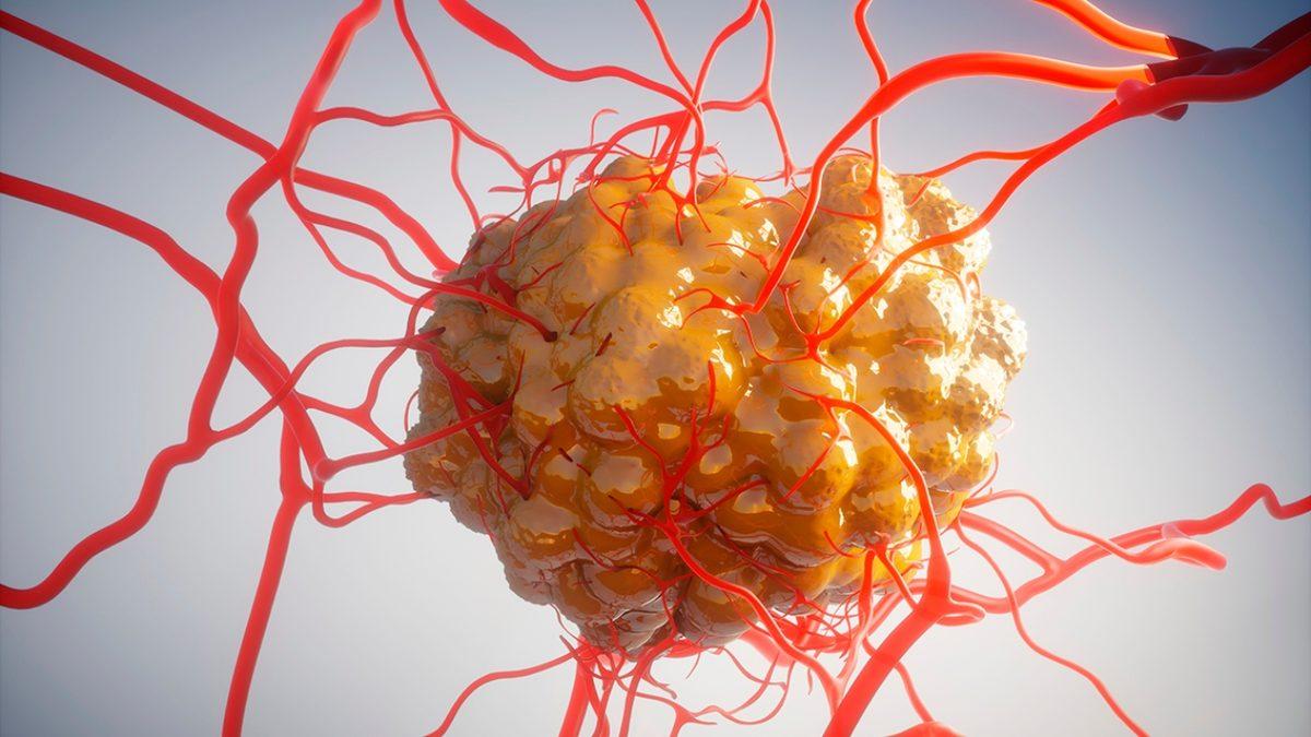 Kanser Hücrelerinin 