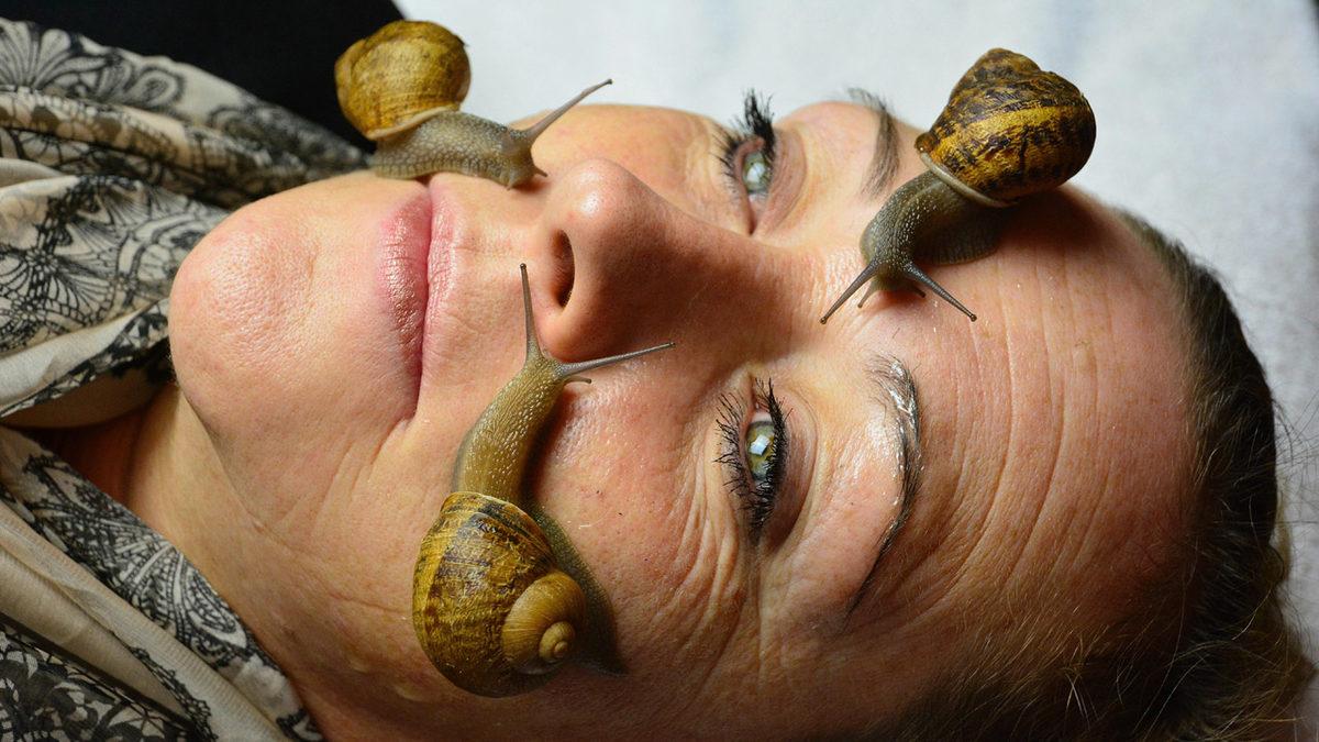 Seda Sayan’ın da Yüzüne Enjekte Ettirdiği 