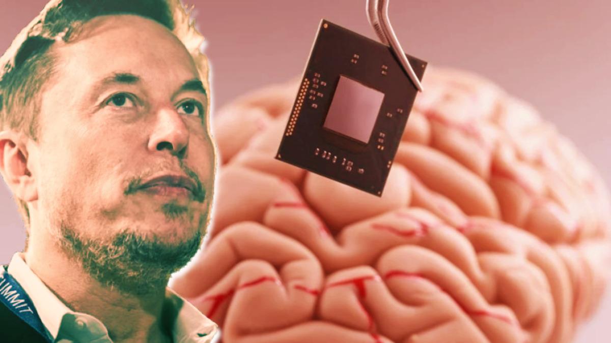Elon Musk’ın İnsan Beynine Çip Takacak "Neuralink" Projesi İçin Ne Kadar Yatırım Topladığı Ortaya Çıktı