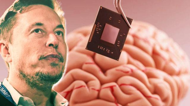 Elon Musk’ın İnsan Beynine Çip Takacak "Neuralink" Projesi İçin Ne Kadar Yatırım Topladığı Ortaya Çıktı