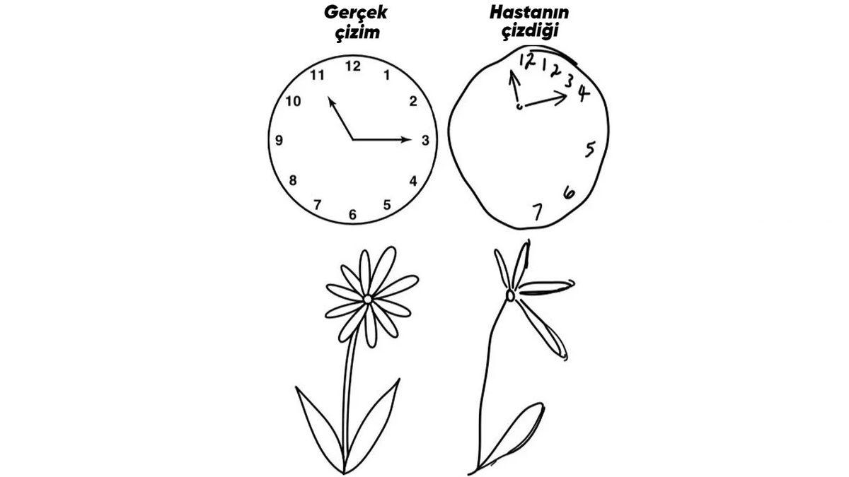 ”Nasıl Yani?” Diyeceksiniz: Yüzün Tek Tarafını Tıraş Edip, Tek Tarafına Makyaj Yapmaya Sebep Olan İhmal Sendromu
