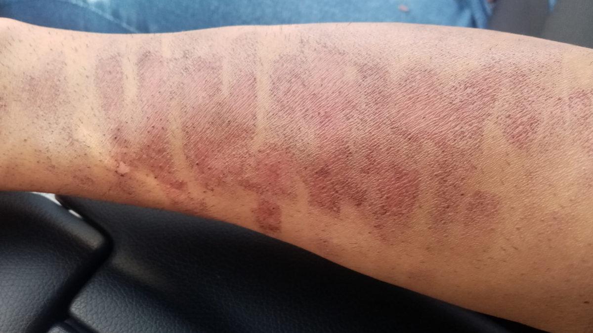 “Hahah Salak” Yazmak Aslında Hakaret Suçu! İşte Günlük Hayatınızda İşinize Yarayacak Bazı Önemli Mahkeme Kararları