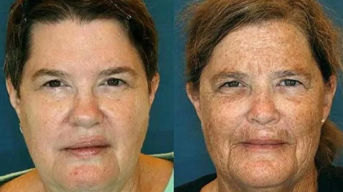 Yüzlerindeki Kırışıklıkların Karşılaştırıldığı İkizlerden Hangilerinin Sigara İçtiğini Tahmin Edebilir misin?