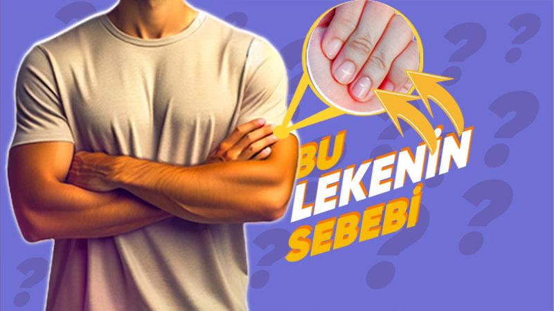 Son Zamanlarda Yemek Yemekten Bile Soğuduysanız Sebebi Bu Olabilir: ’Çinko Eksikliği’ Nedir, Neden Olur, Belirtileri Nelerdir?