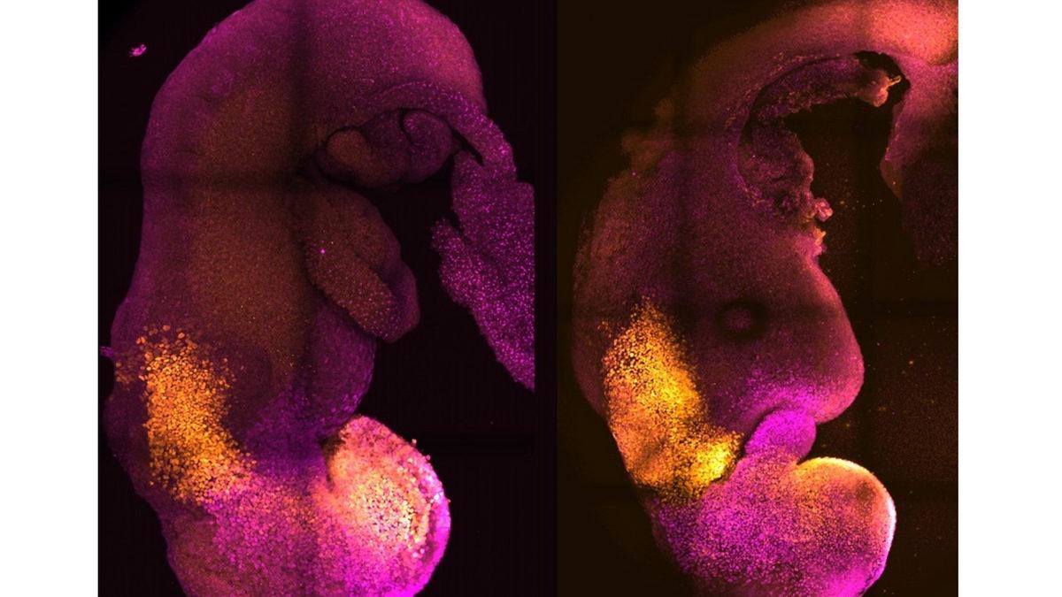 Zihin Okuma Cihazı, Sentetik İnsan Embriyosu ve Dahası: Geleceğin Kapılarını Aralayan Bilimsel Keşiflerin 2023 Özetini Çıkardık