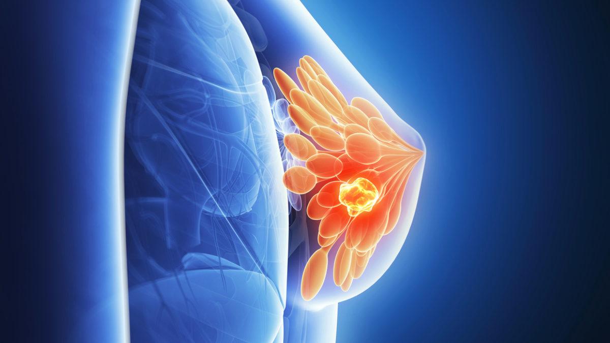 Bildiklerinizi Unutun: Sütyen Takmak, Memeleri Sarkıtır mı Yoksa Dikleştirir mi?