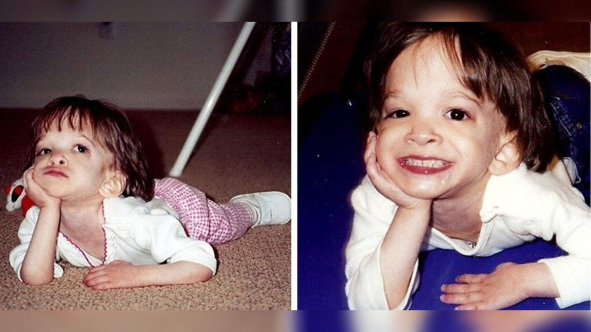 Benjamin Button’ın Çocuğu: Bir Bebeğin Bedeninde Sıkışıp Kalan 20 Yaşındaki Kızın Tuhaf Hikâyesi