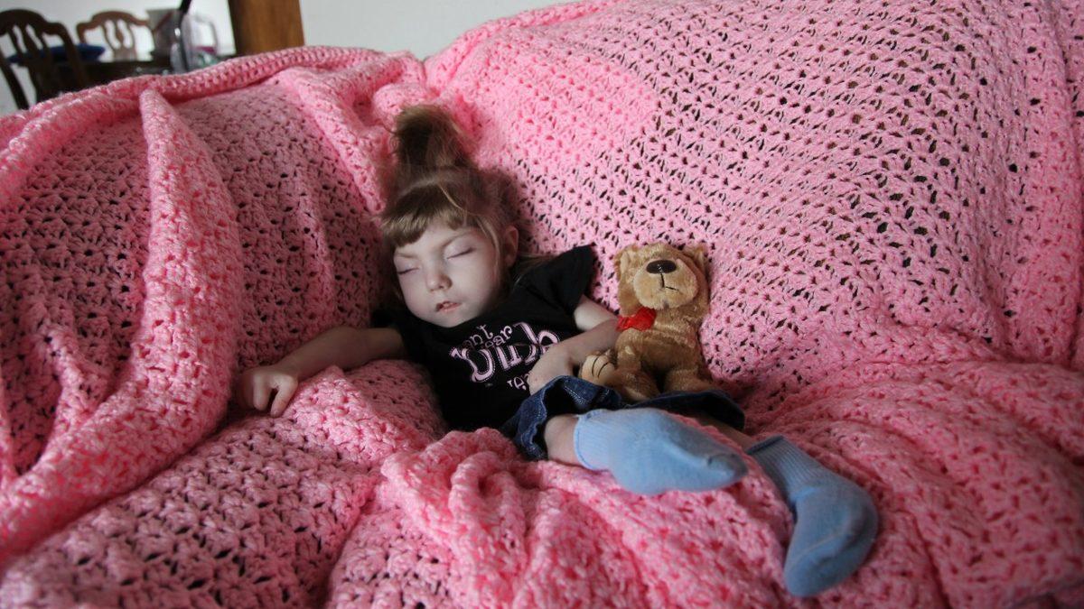 Benjamin Button’ın Çocuğu: Bir Bebeğin Bedeninde Sıkışıp Kalan 20 Yaşındaki Kızın Tuhaf Hikâyesi