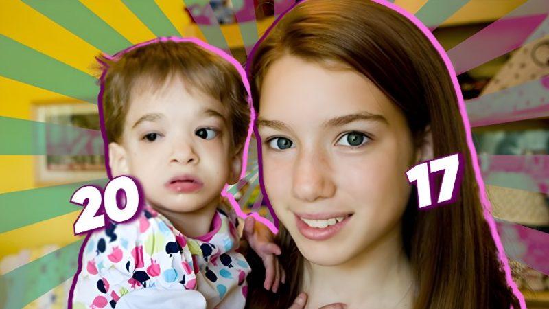 Benjamin Button’ın Çocuğu: Bir Bebeğin Bedeninde Sıkışıp Kalan 20 Yaşındaki Kızın Tuhaf Hikâyesi