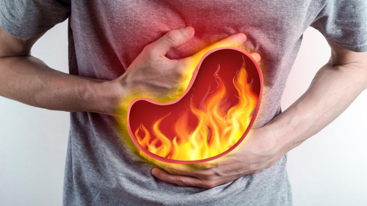 Midenizde Sıklıkla Ağrı ve Yanma Hissediyorsanız Nedeni Bu Olabilir: Ülser Nedir, Belirtileri Nelerdir?
