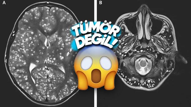 Beyin MR’ındaki Bu Noktaların Ne Olduğunu Öğrenince Yemek Yaparken İki Kez Düşüneceksiniz