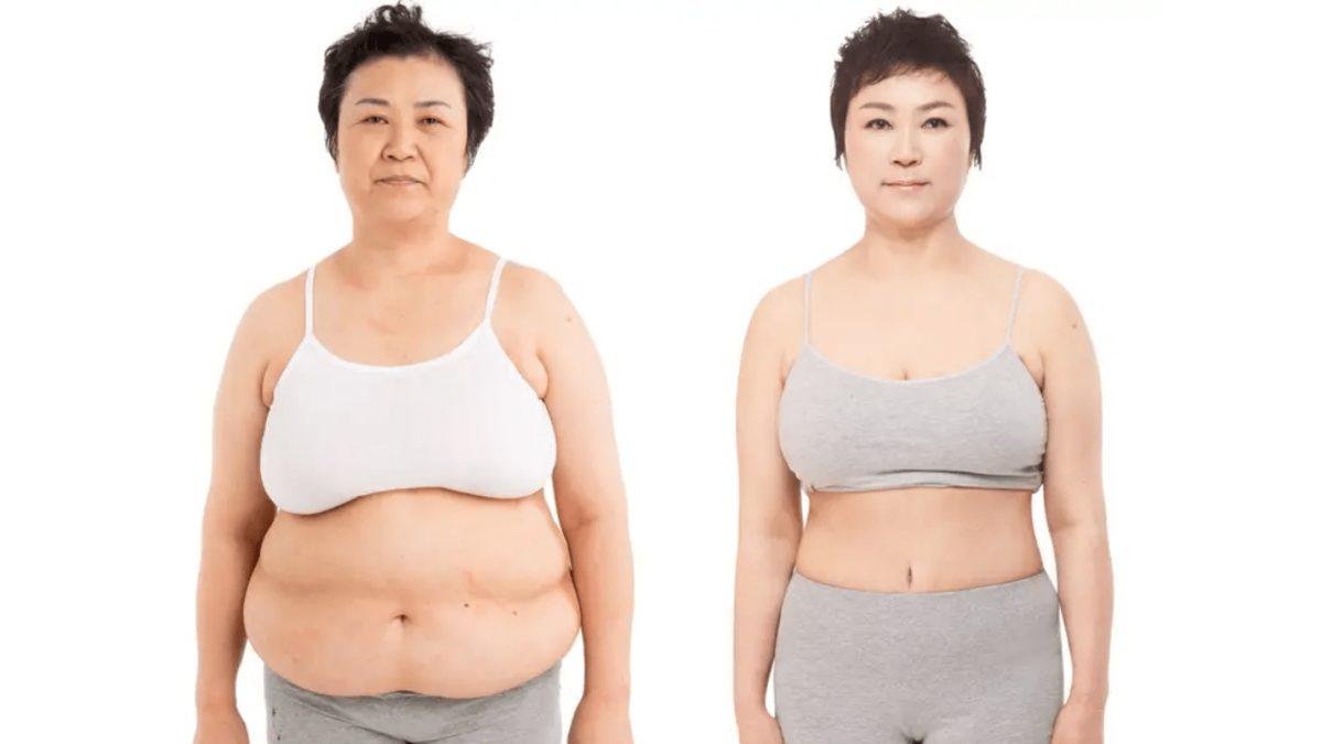 Korelilerin Bu Kadar Estetik Düşkünü Olmasının Arkasında Ne Gibi Sebepler Var? Her 3 Kişiden 1’i Ameliyat Oluyor!