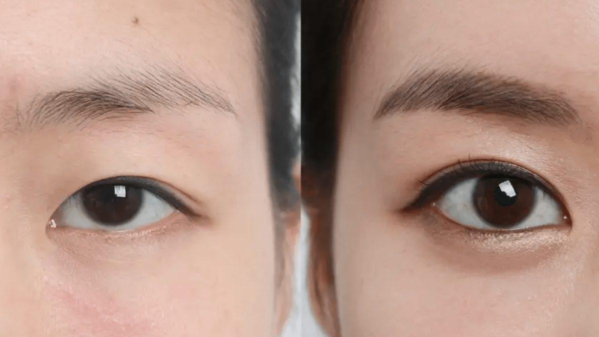 Korelilerin Bu Kadar Estetik Düşkünü Olmasının Arkasında Ne Gibi Sebepler Var? Her 3 Kişiden 1’i Ameliyat Oluyor!