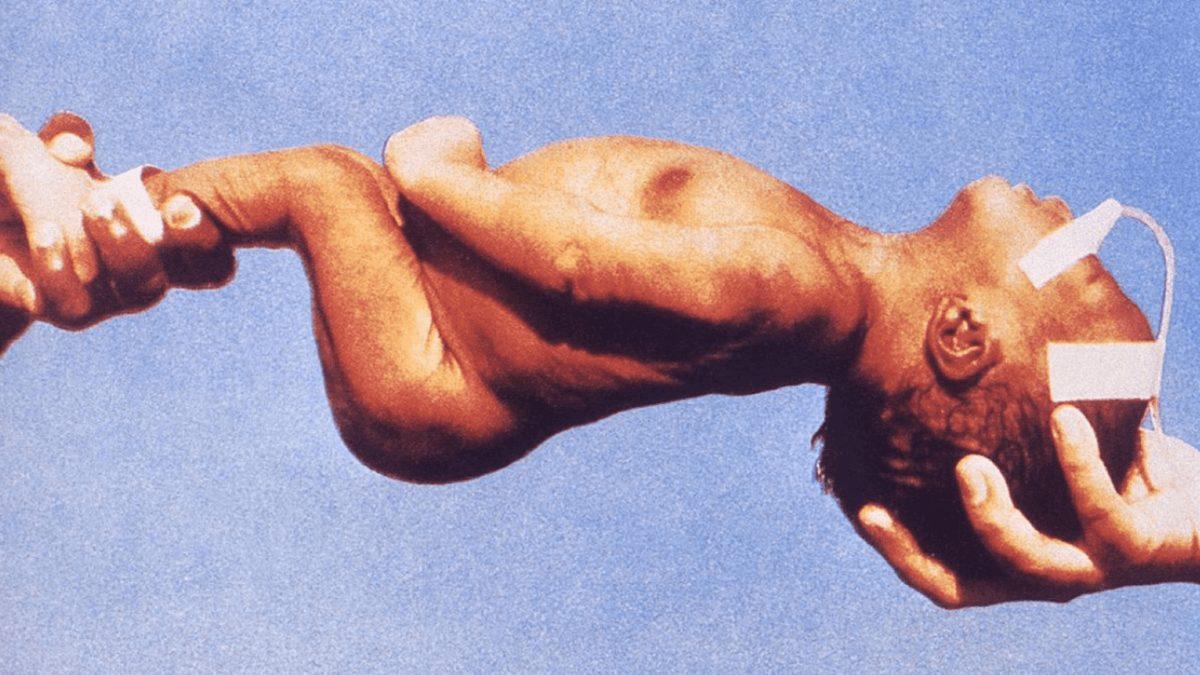 İnsanı Yay Gibi Eğerek İki Büklüm Yapan Korkunç Hastalık: Tetanos