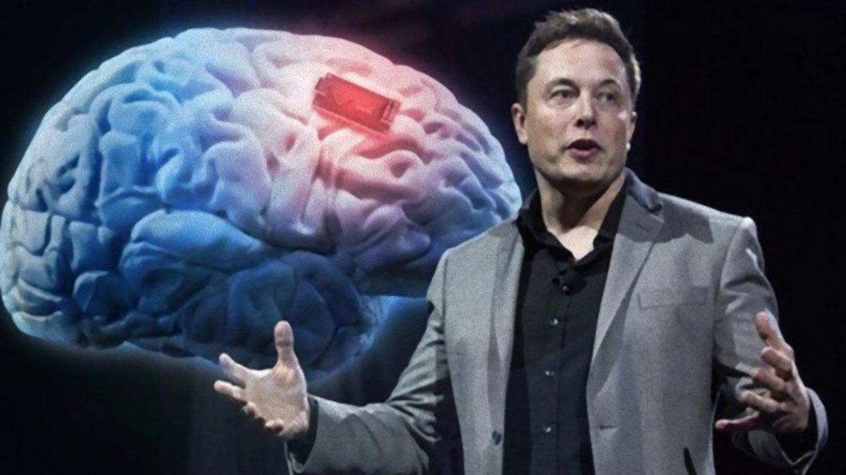 Elon Musk, Neuralink’in İlk Kez Bir İnsan Beynine Çip Taktığını Açıkladı