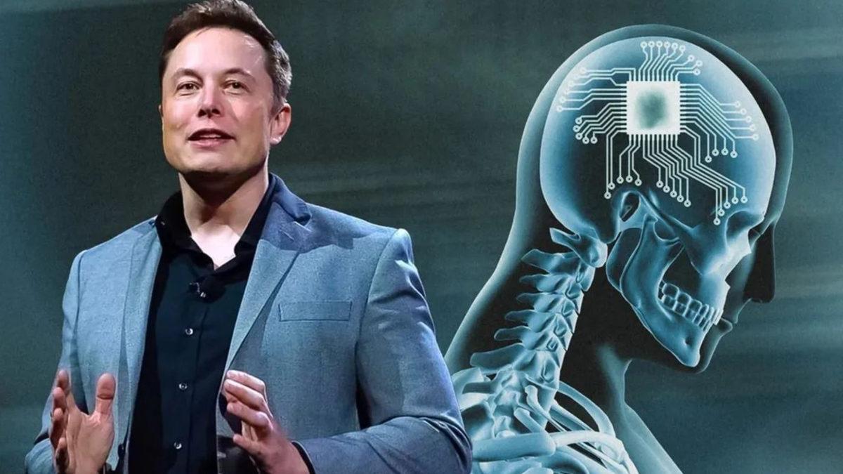 Elon Musk, Bir Felakete Neden Olabilir! Neuralink’in İnsan Beynine Taktığı Çip, Tam Olarak Ne İşe Yarıyor ve Nasıl Çalışıyor?