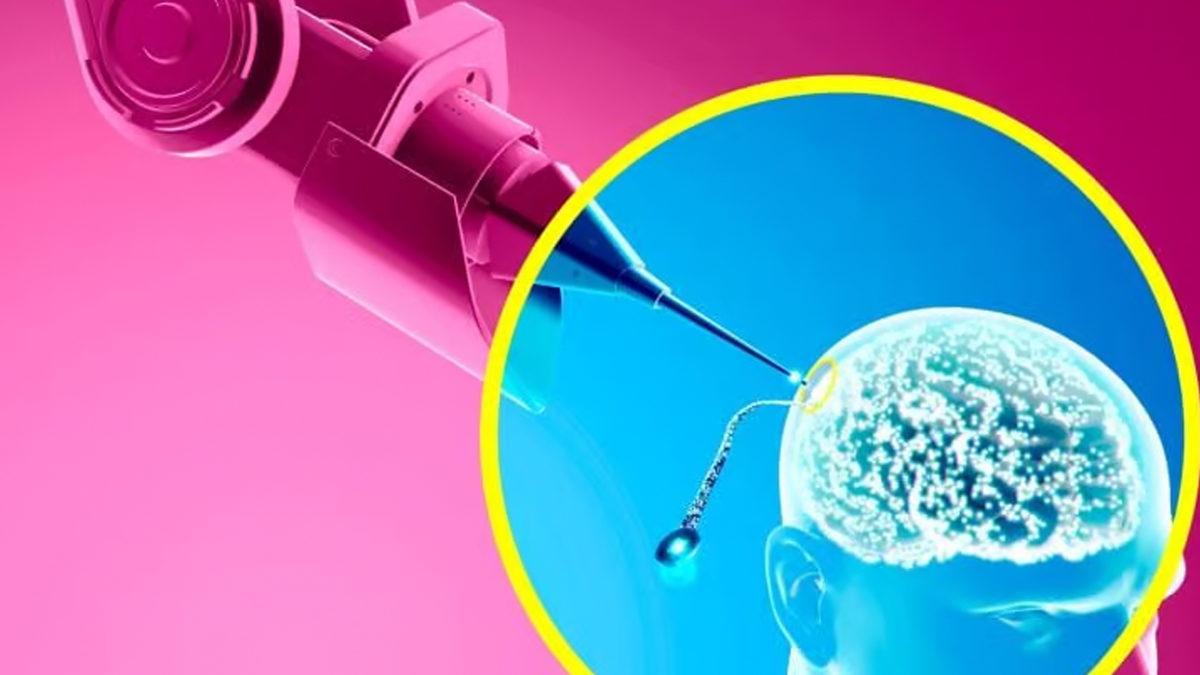 Elon Musk, Bir Felakete Neden Olabilir! Neuralink’in İnsan Beynine Taktığı Çip, Tam Olarak Ne İşe Yarıyor ve Nasıl Çalışıyor?