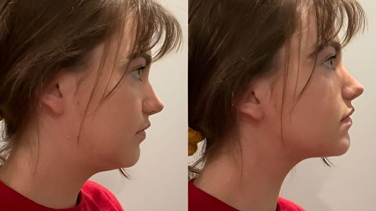 Dil Konumunun Çekiciliğiniz Üstündeki Etkisini Öğrenince Başka Şekilde Konumlandırmayı Düşünemeyeceksiniz!