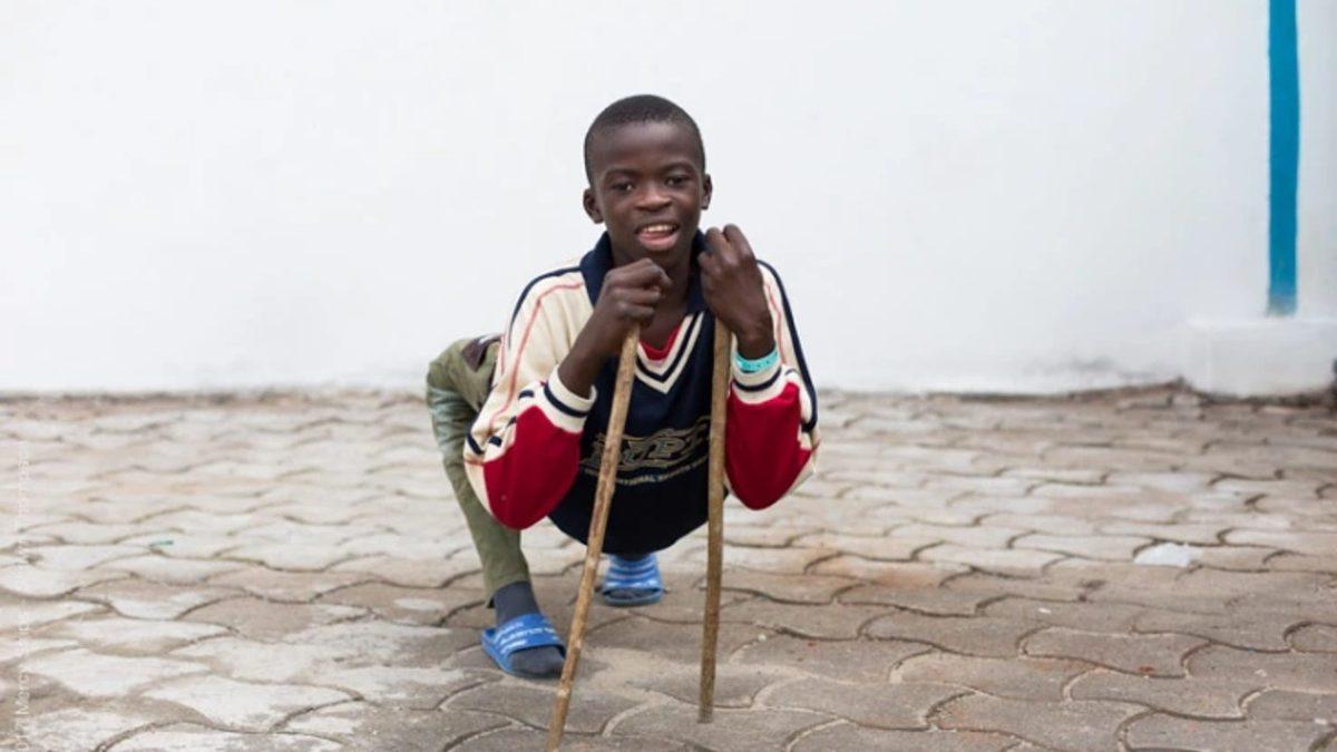 Vücudun Kâğıt Gibi İkiye Katlanmasına Sebep Olan Rahatsız Edici Hastalık: Kuadriseps Kontraktürü