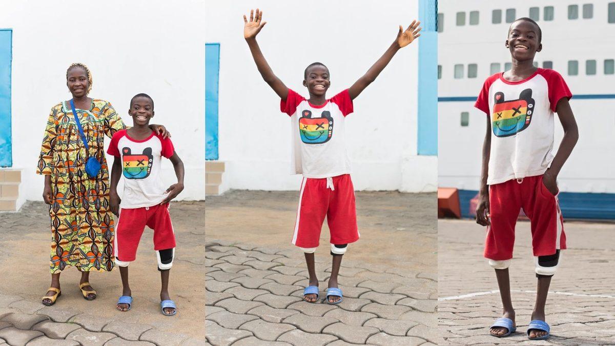 Vücudun Kâğıt Gibi İkiye Katlanmasına Sebep Olan Rahatsız Edici Hastalık: Kuadriseps Kontraktürü