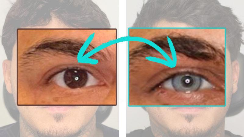 Göz Renginizi Estetik Operasyonla Değiştirmek İstediğinizde Neleri "Göze Almanız" Gerekir?