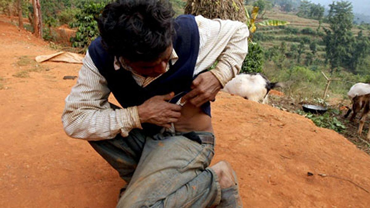 Güney Asya’nın Bu Kasabasında Yaşayan Herkes Tek Böbreğe Sahip: Sebebi ise İçler Acısı!