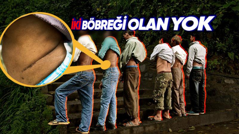 Güney Asya’nın Bu Kasabasında Yaşayan Herkes Tek Böbreğe Sahip: Sebebi ise İçler Acısı!