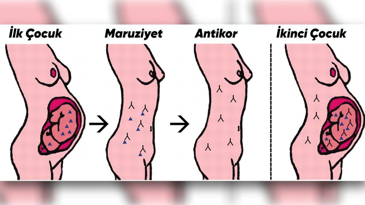 Ağabeyi Olan Kişilerin Eş Cinsel Olma İhtimali Daha Doğum Esnasındayken Yükseliyor: İyi de Nasıl?