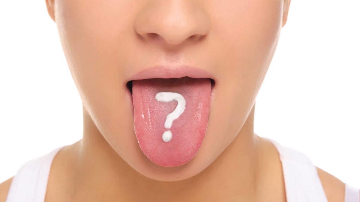 Dilimizde Oluşan Bu Beyazlıkların Altında Yatan Sebep Tam Olarak Ne?