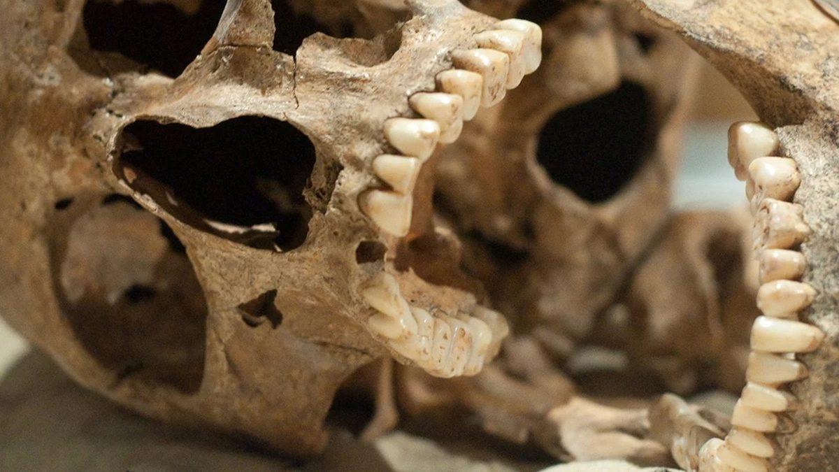 Ne Diş Fırçası Ne de Diş Macunu Kullanan Eski İnsanların Dişleri Neden Hiç Çürümüyordu?