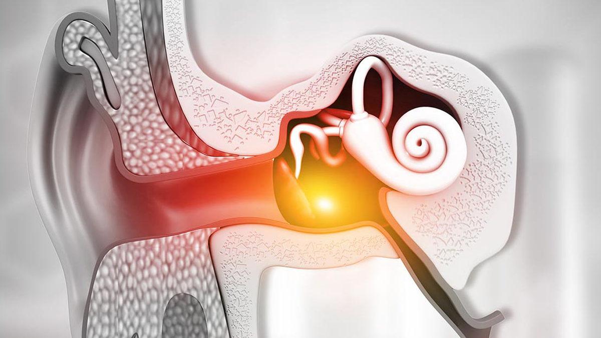 Eğer Kulak Çınlaması Yaşıyorsanız Altında Yatan Bu 7 Sebebe Göz Atmak İsteyebilirsiniz