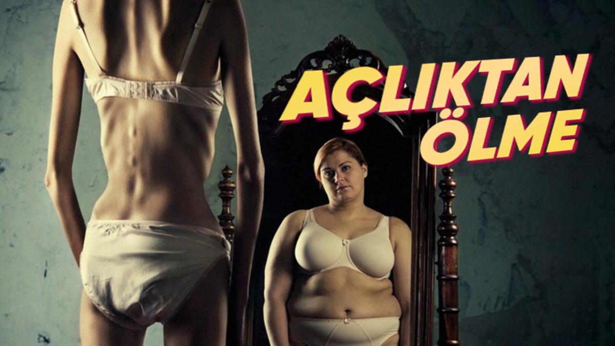 İnsanlara ’Manken Gibi Olmalıyım’ Yanılgısıyla Gram Hesabı Bile Yaptırıp Bir Deri Bir Kemik Bırakan Hastalık: Anoreksiya