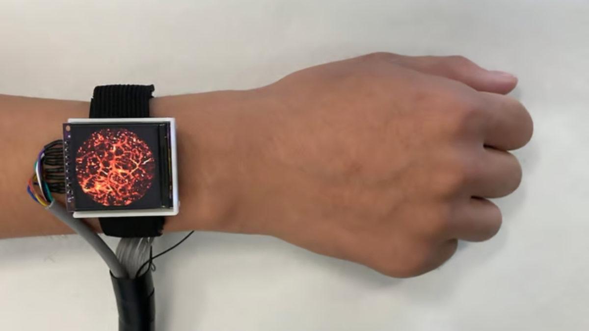 Damarlarınızdaki Kan Akışını Anlık Olarak Gösteren 